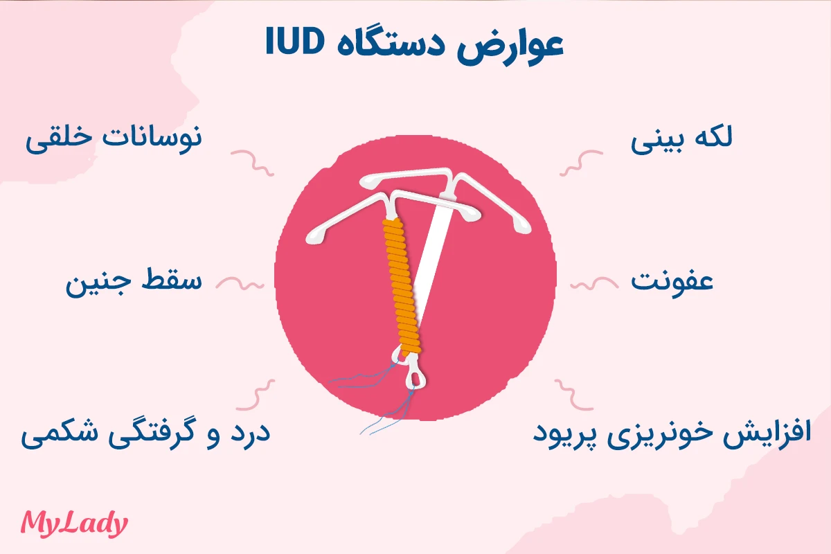 عوارض دستگاه IUD