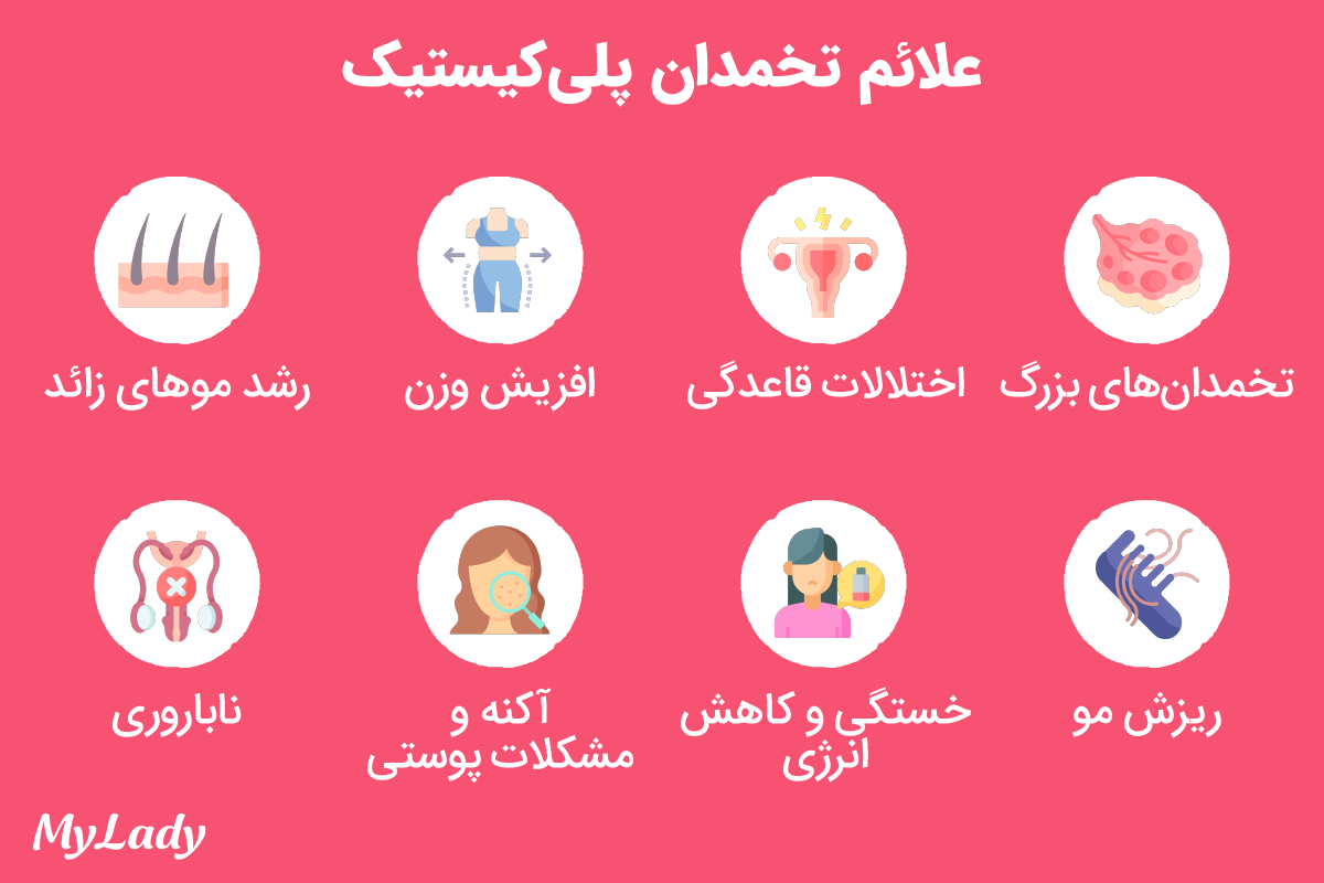 علائم تنبلی تخمدان (PCOS)