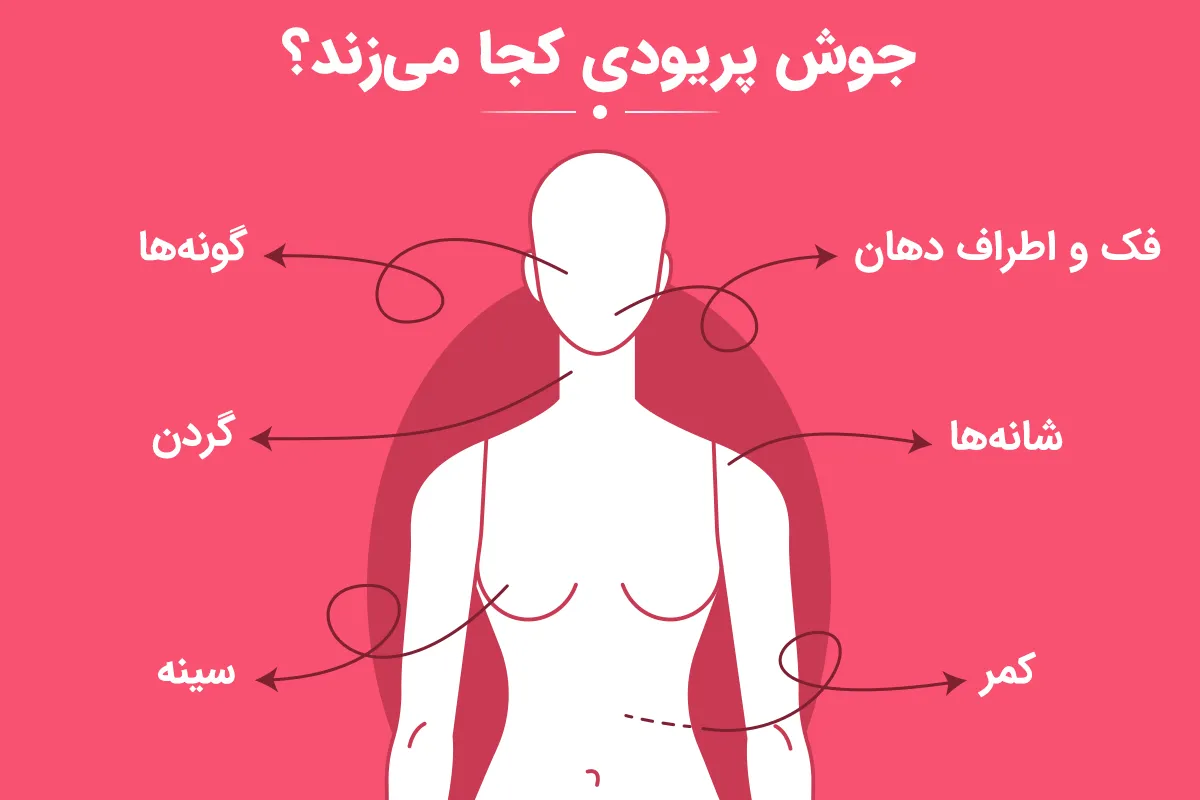 جوش پریودی کجا می‌زند؟
